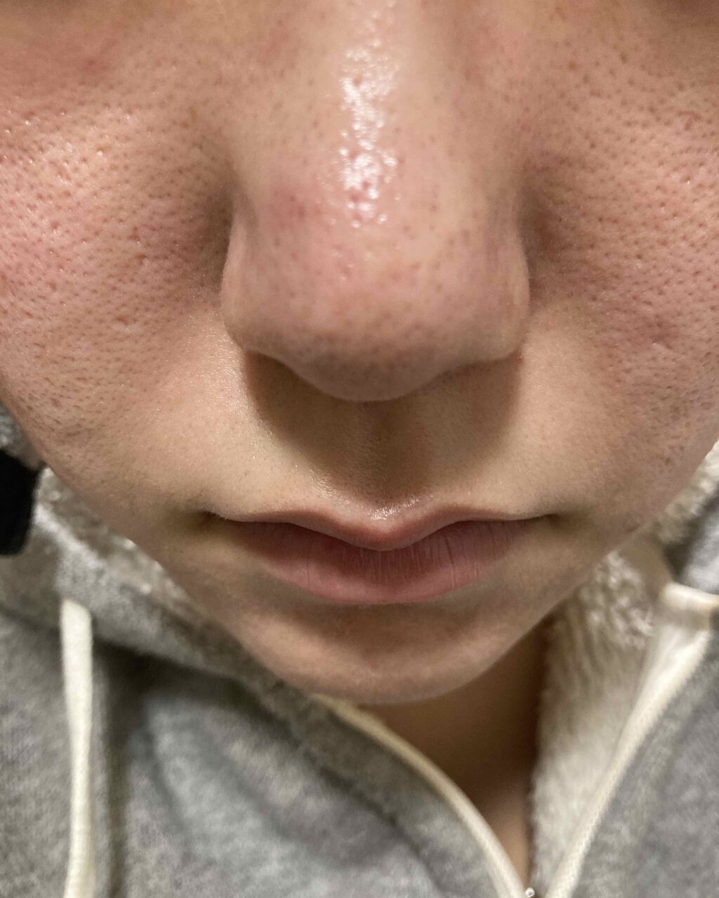 オバジC10セラム/オバジ/美容液を使ったクチコミ（2枚目）