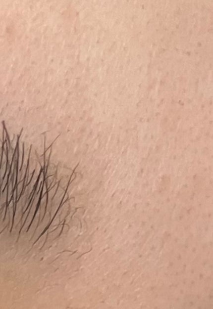 あ on LIPS 「助けてください😢私顔の毛穴が目立つのが悩みで、特に鼻の黒ずみと..」(3枚目)