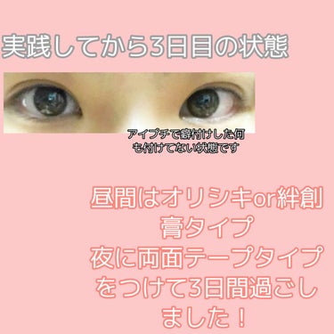 アイテープ（絆創膏タイプ、レギュラー、７０枚）/DAISO/二重まぶた用アイテムを使ったクチコミ（3枚目）