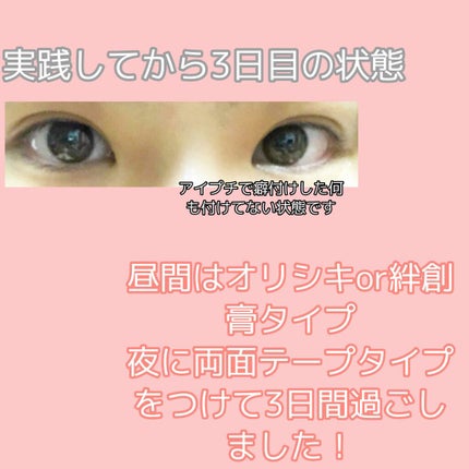 アイテープ(絆創膏タイプ、レギュラー、70枚)/DAISO/二重まぶた用アイテムを使ったクチコミ(3枚目)