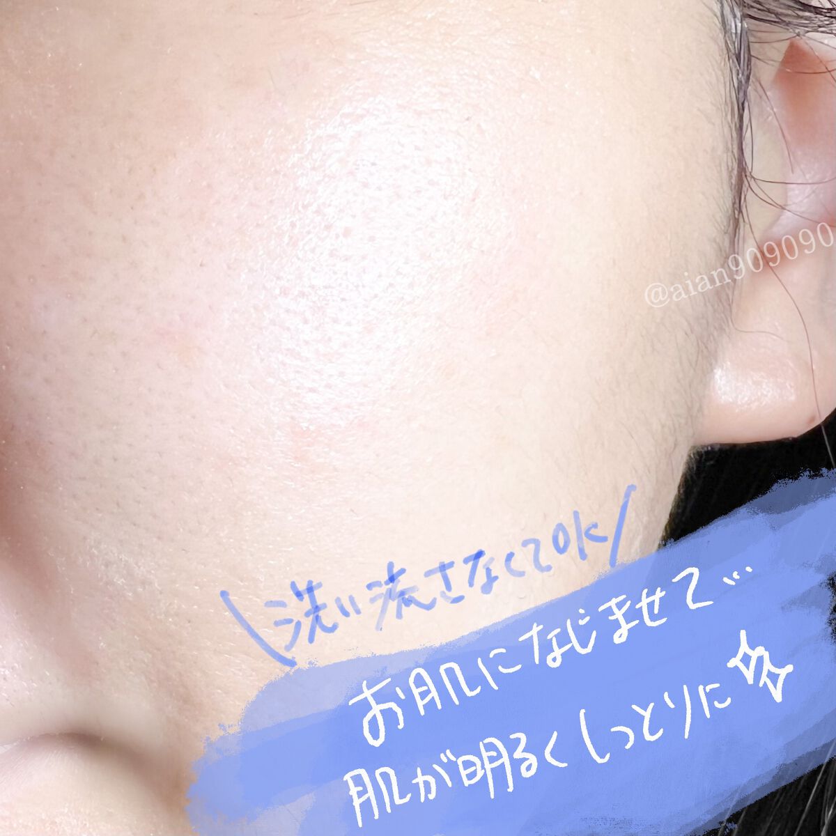 マジックバブルエッセンスパックMINI/BAKER7/シートマスク・パックを使ったクチコミ(5枚目)