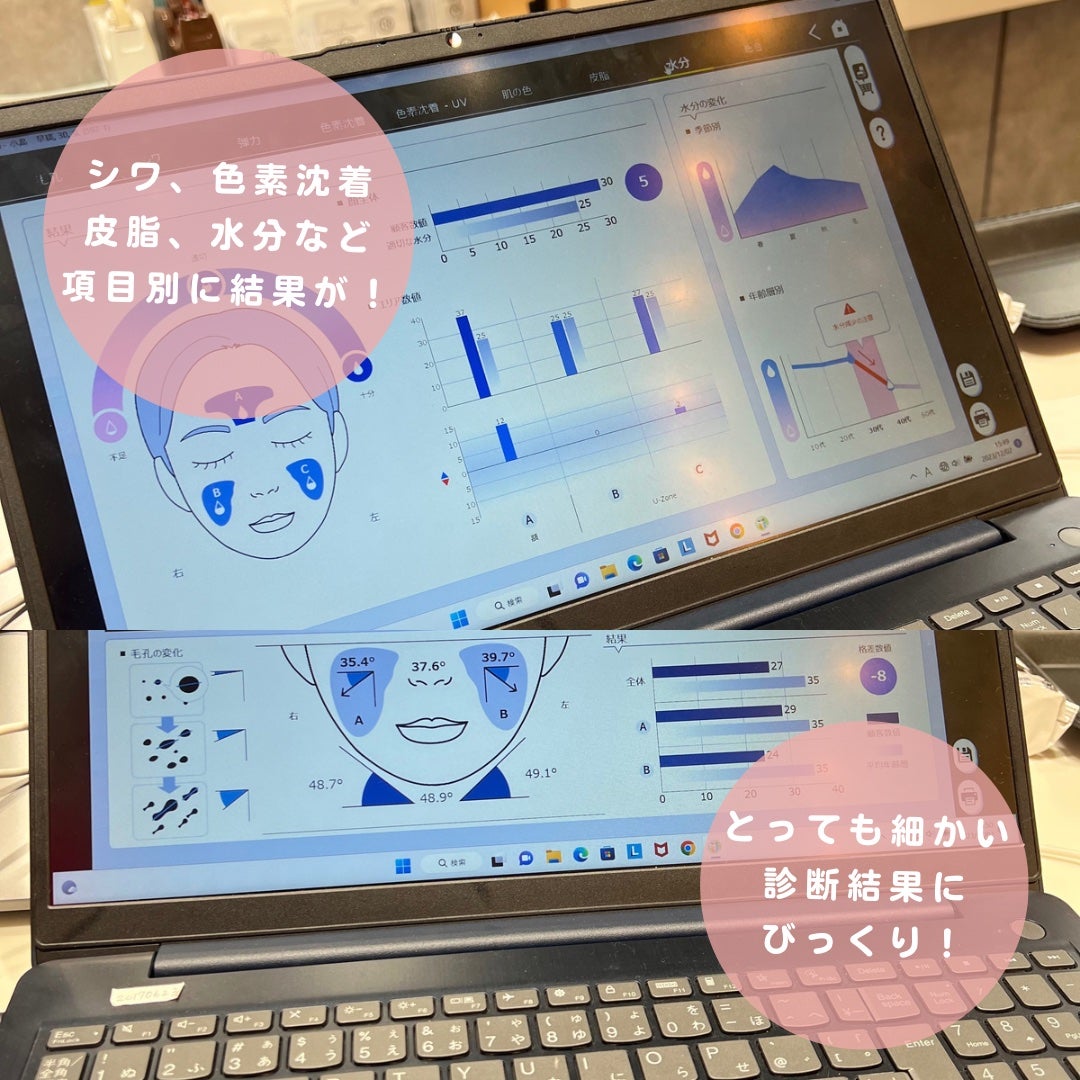 AA EYE CREAM/Shangpree/アイケア・アイクリームを使ったクチコミ(4枚目)