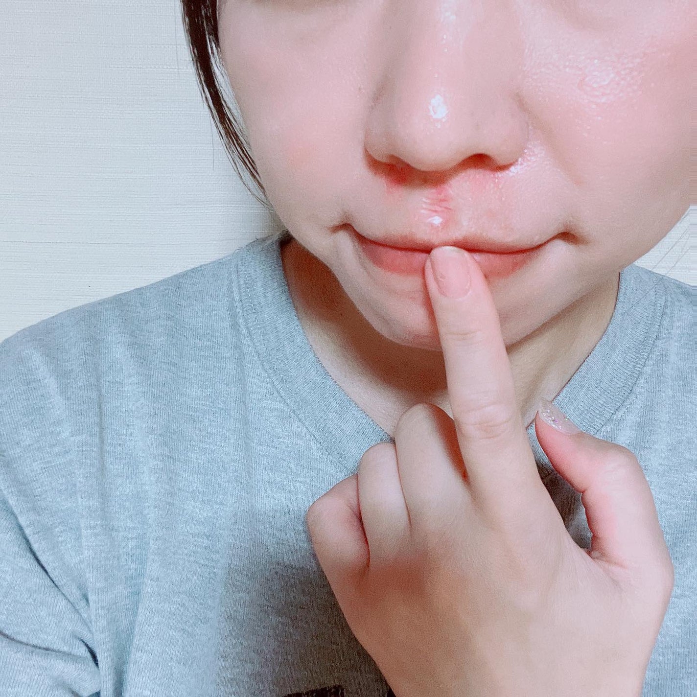 極薄透明パッチ nikipa!/金冠堂/にきびパッチを使ったクチコミ(3枚目)