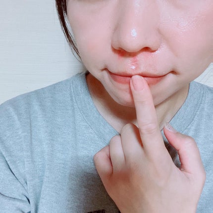 極薄透明パッチ nikipa!/金冠堂/にきびパッチを使ったクチコミ(3枚目)