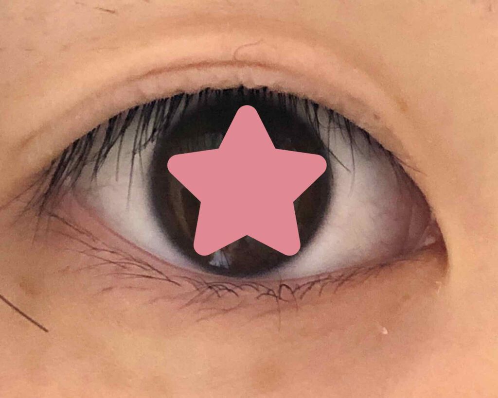 アイビューティー フィクサー WP/アストレア ヴィルゴ/二重まぶた用アイテムを使ったクチコミ（1枚目）