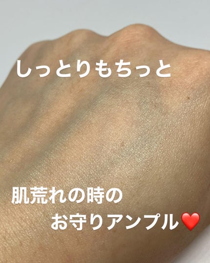 ドクダミ80%スージングアンプル/Anua/美容液を使ったクチコミ(4枚目)