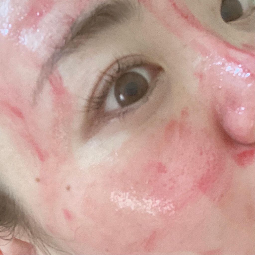 AHA 30% + BHA 2% Peeling Solution/The Ordinary/ピーリングを使ったクチコミ(2枚目)