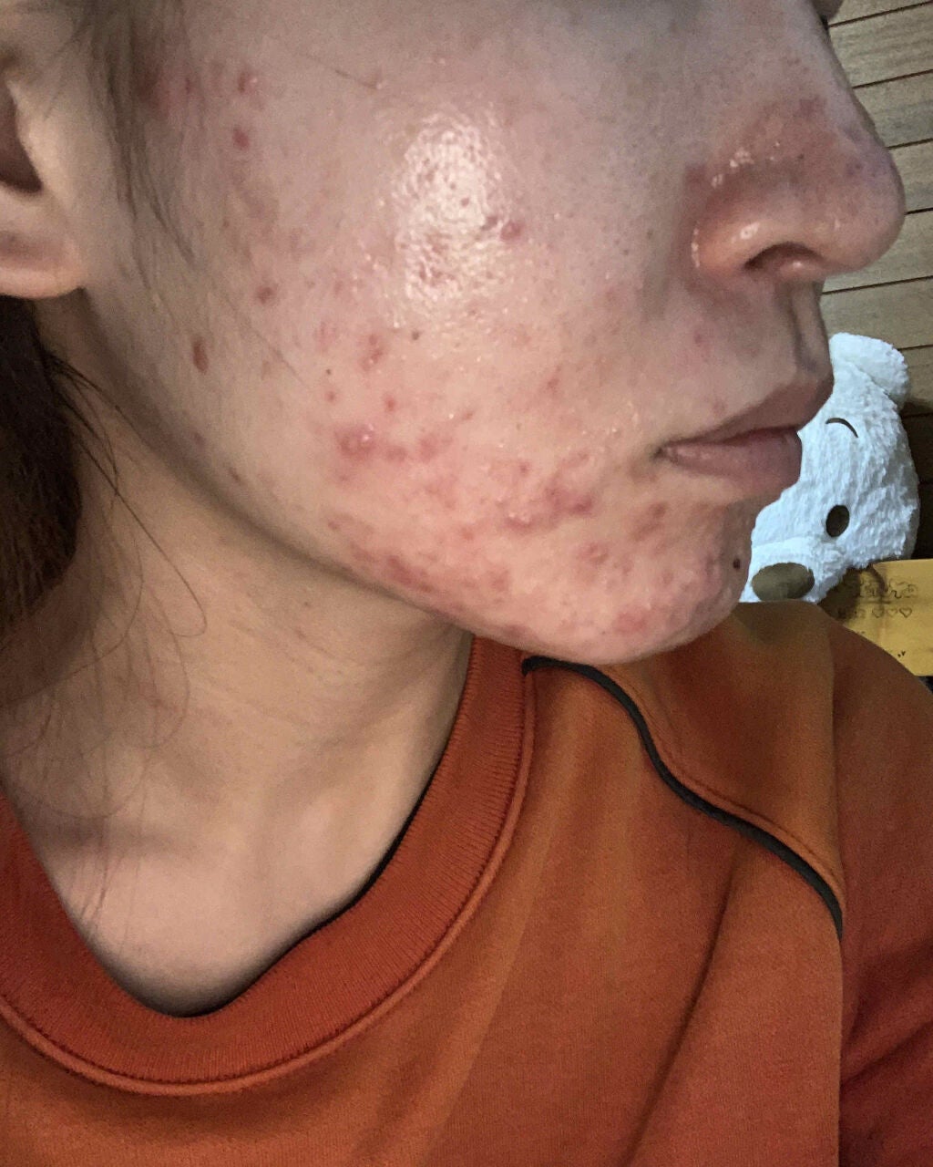 アルソア クイーンシルバー/アルソア/洗顔石鹸を使ったクチコミ(2枚目)