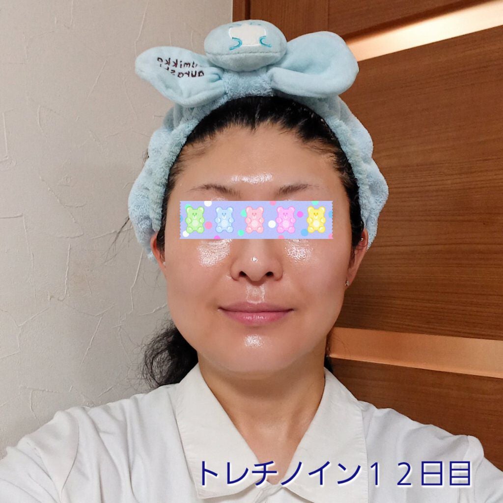 極潤α リフトクリーム/肌ラボ/フェイスクリームを使ったクチコミ(1枚目)