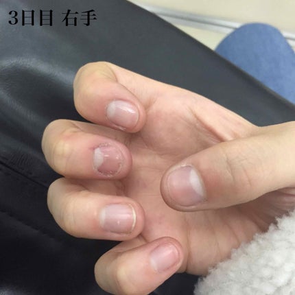 ピンクピンク on LIPS 「みなさんこんにちはこんばんは今日は爪を噛んでしまう癖をなくそう..」(2枚目)