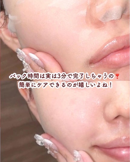 ダーマレーザー スーパーNMN100マスク/クオリティファースト/シートマスク・パックを使ったクチコミ(5枚目)