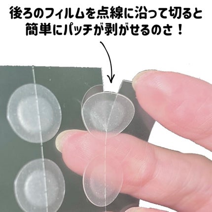 エイクリアスポットキュアパッチ/Dr.G/その他スキンケアを使ったクチコミ(4枚目)