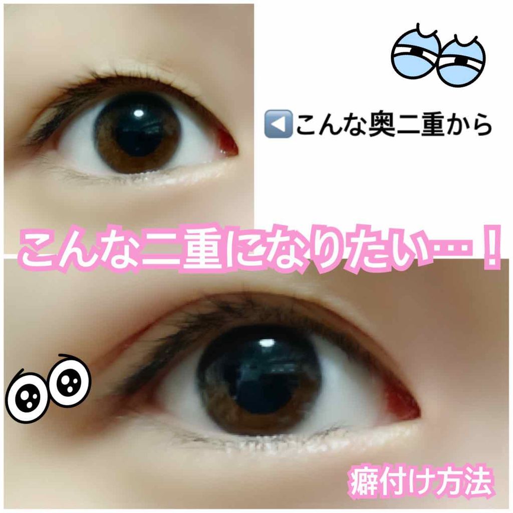 のびーるアイテープ（絆創膏タイプ、レギュラー）/DAISO/二重まぶた用アイテムを使ったクチコミ（1枚目）