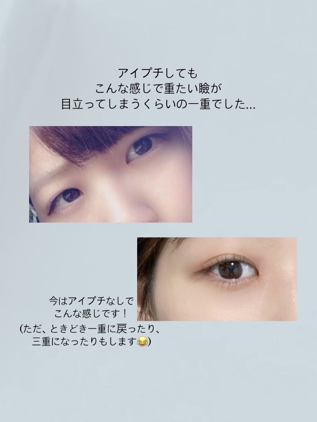 アイプチ リキッドテープN/アイプチ®/二重まぶた用アイテムを使ったクチコミ（2枚目）