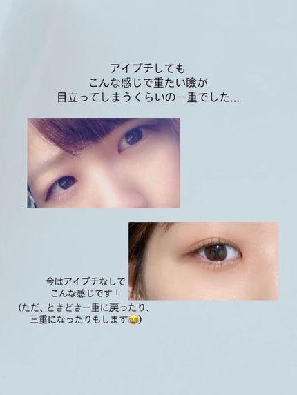 ナイトアイボーテ/StreeTrend/二重まぶた用アイテムを使ったクチコミ(2枚目)