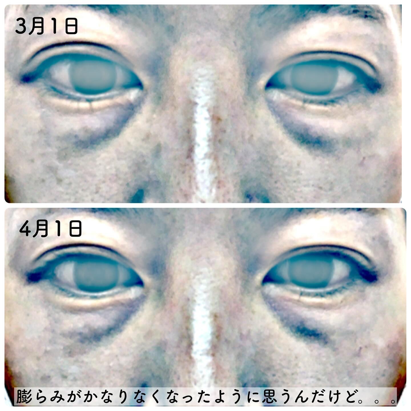 試してみた】Face-Trigger COREFITの効果・肌質別の口コミ