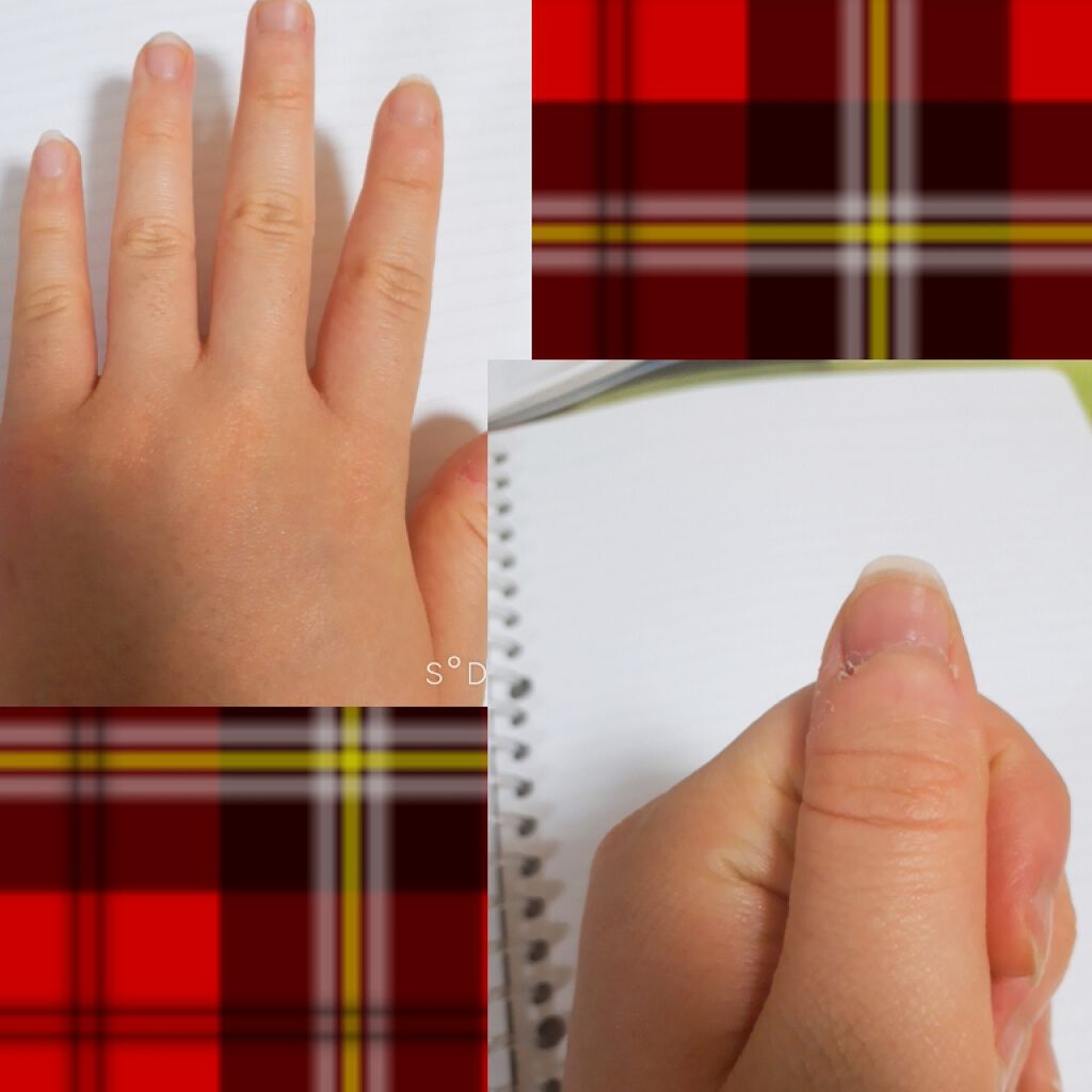 ネイルサポート ピンク/ネイルネイル/ネイルベースコートを使ったクチコミ(2枚目)