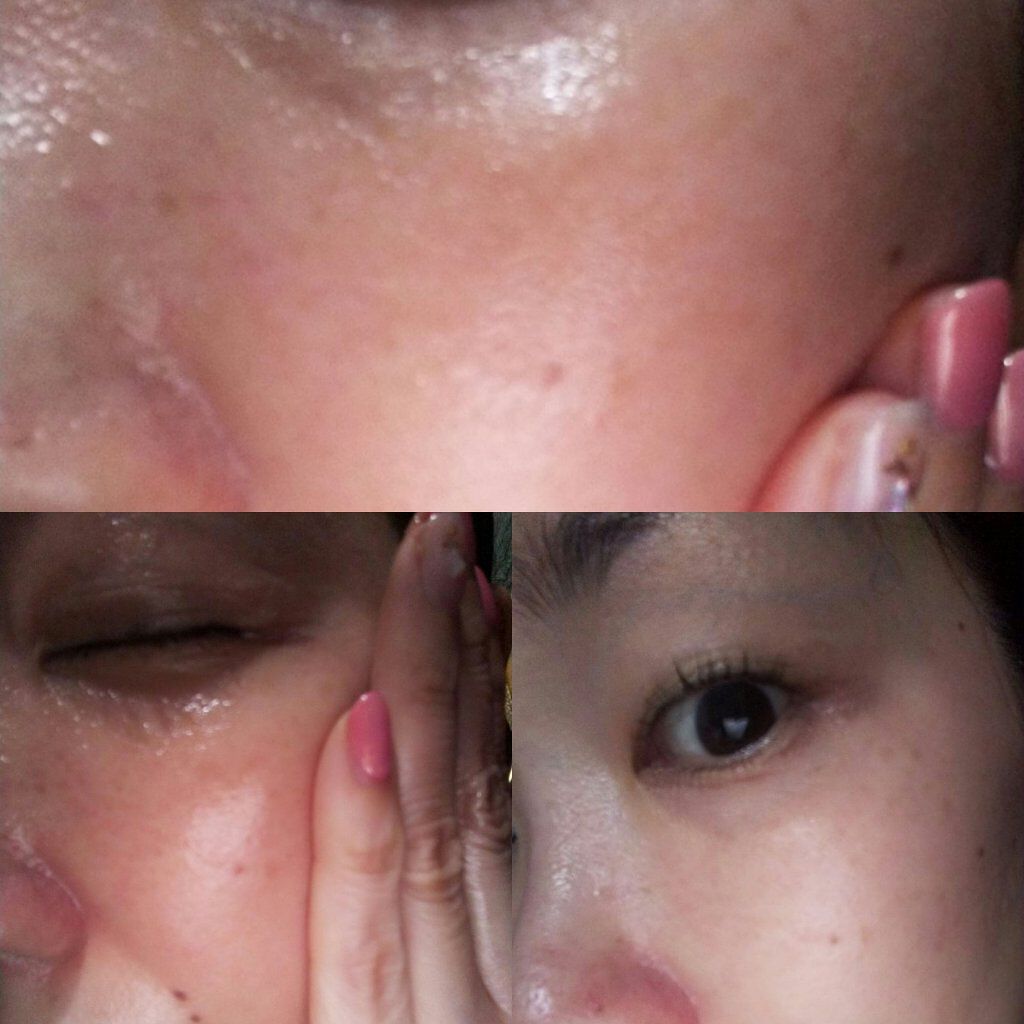 ツーウェイ モイスチャー ローション/ORTHO BLOOM/美容液を使ったクチコミ（2枚目）