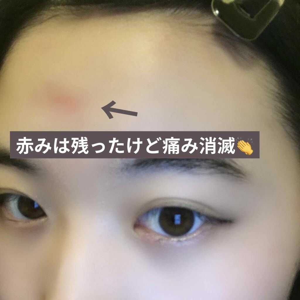 ビジャ シカバーム EX/innisfree/フェイスバームを使ったクチコミ（2枚目）