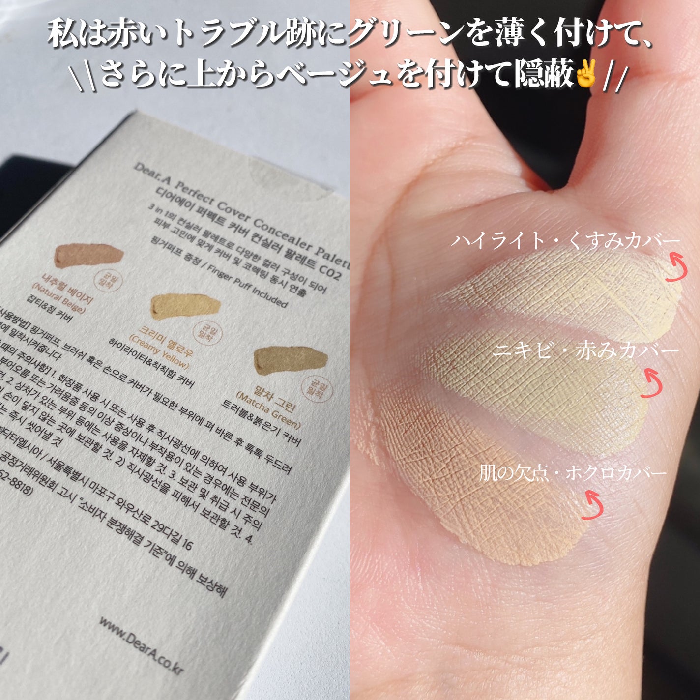 パーフェクトカバー コンシーラーパレット/Dear.A/パレットコンシーラーを使ったクチコミ(4枚目)