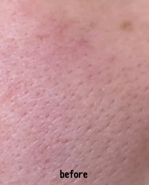 レチノール シカ リペア セラム/innisfree/美容液を使ったクチコミ(2枚目)