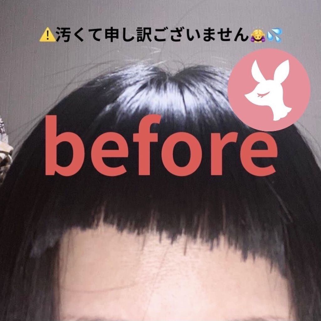 DHC 亜鉛/DHC/健康サプリメントを使ったクチコミ（3枚目）