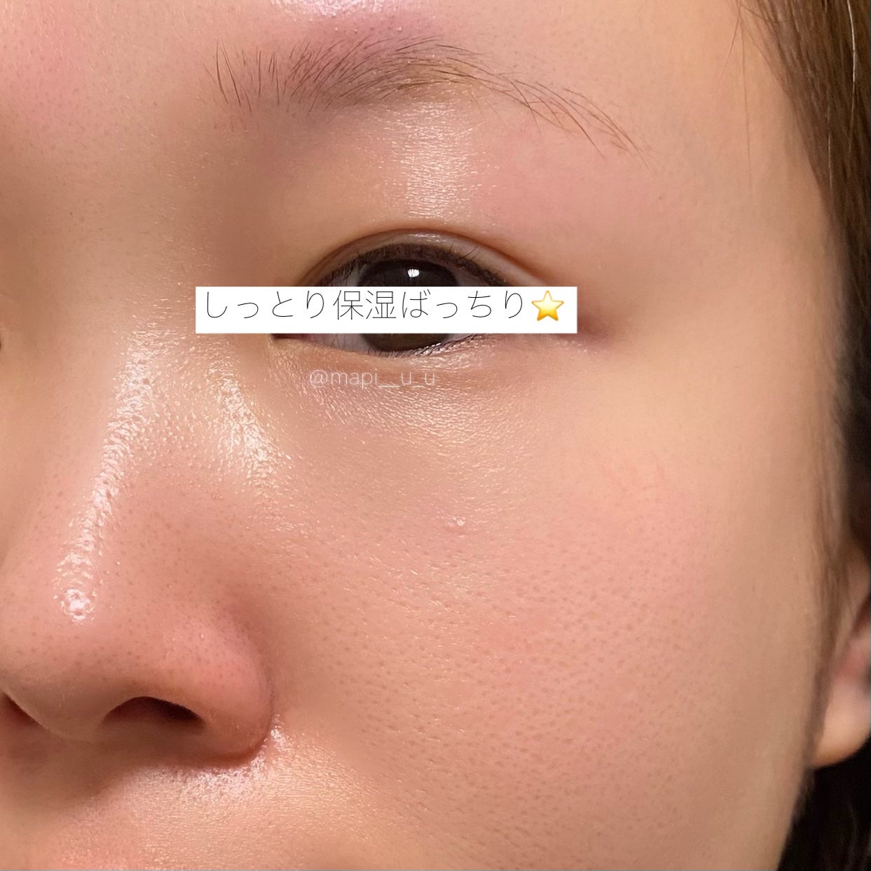 VC100エッセンスローション EX/ドクターシーラボⓇ/化粧水を使ったクチコミ(4枚目)