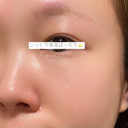 VC100エッセンスローション EX/ドクターシーラボⓇ/化粧水を使ったクチコミ(4枚目)