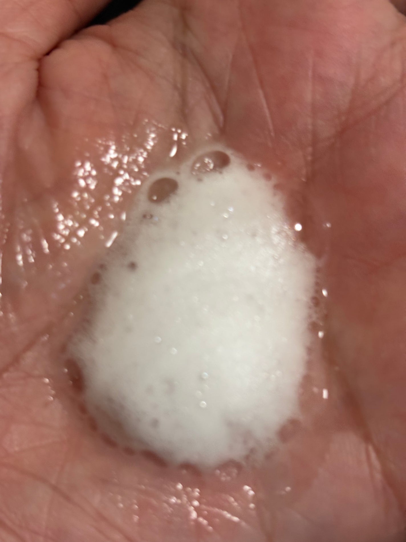 みほっぴ on LIPS 「がんサバイバーの通院日記今月から放射線治療スタート放射線治療は..」(3枚目)