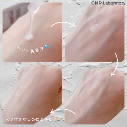 ダーマアンサー PDRN アクティブブースト1:1アンプル/CNP Laboratory/美容液を使ったクチコミ(5枚目)