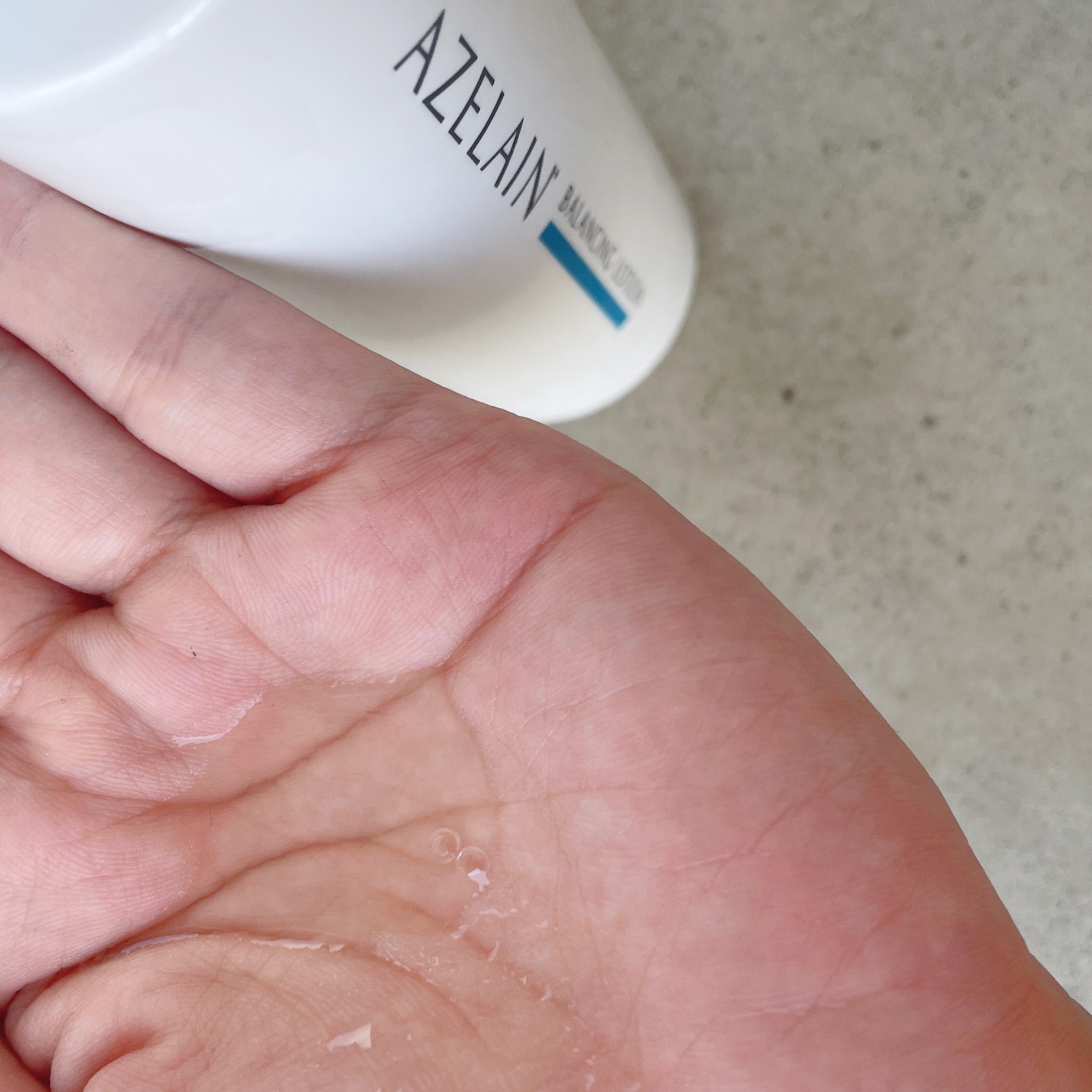 AZLAIN　化粧水　AZバランシングローション/AZELAIN/化粧水を使ったクチコミ（2枚目）