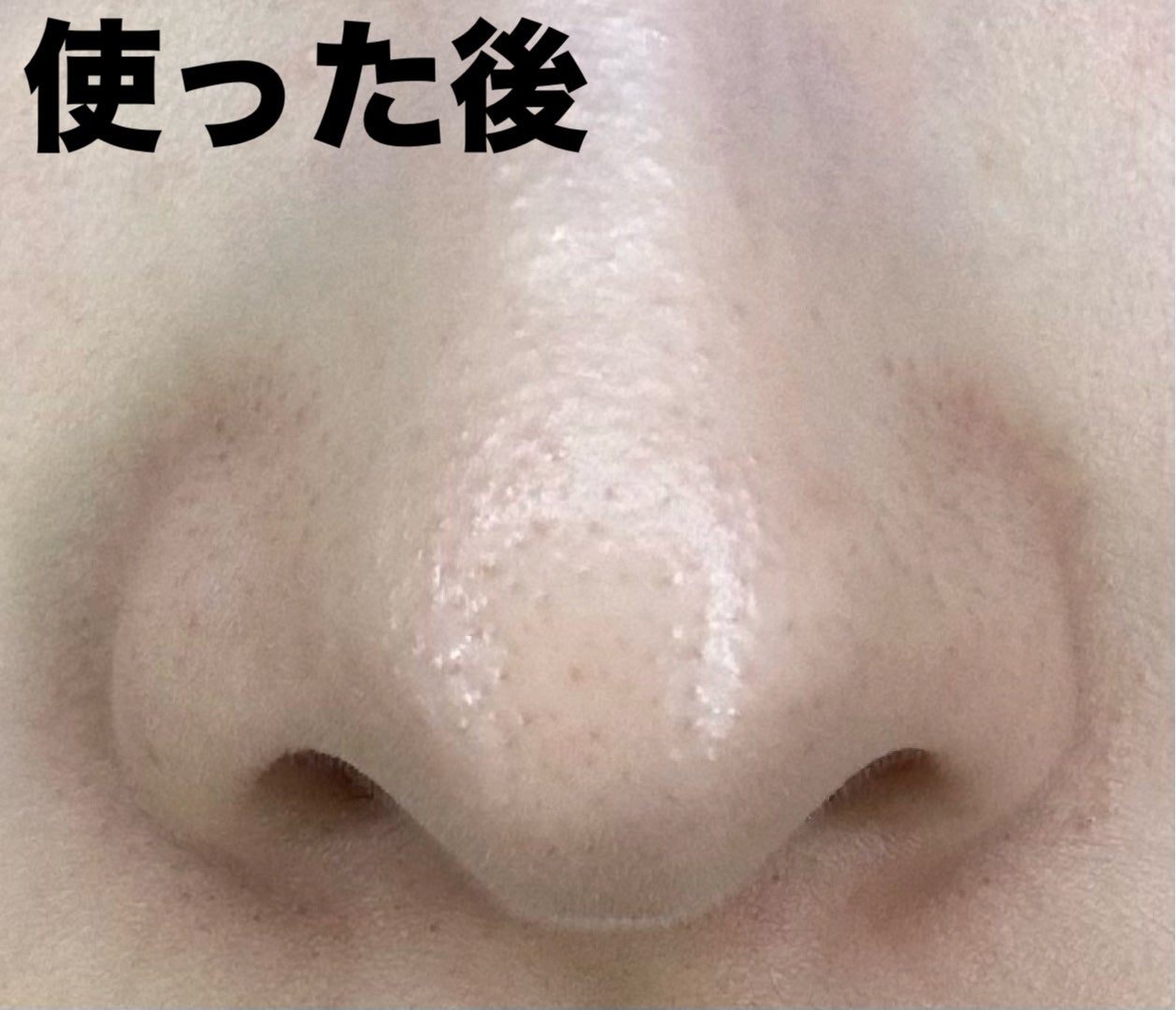 ノーズピーリングパック/One-day's you/シートマスク・パックを使ったクチコミ(3枚目)