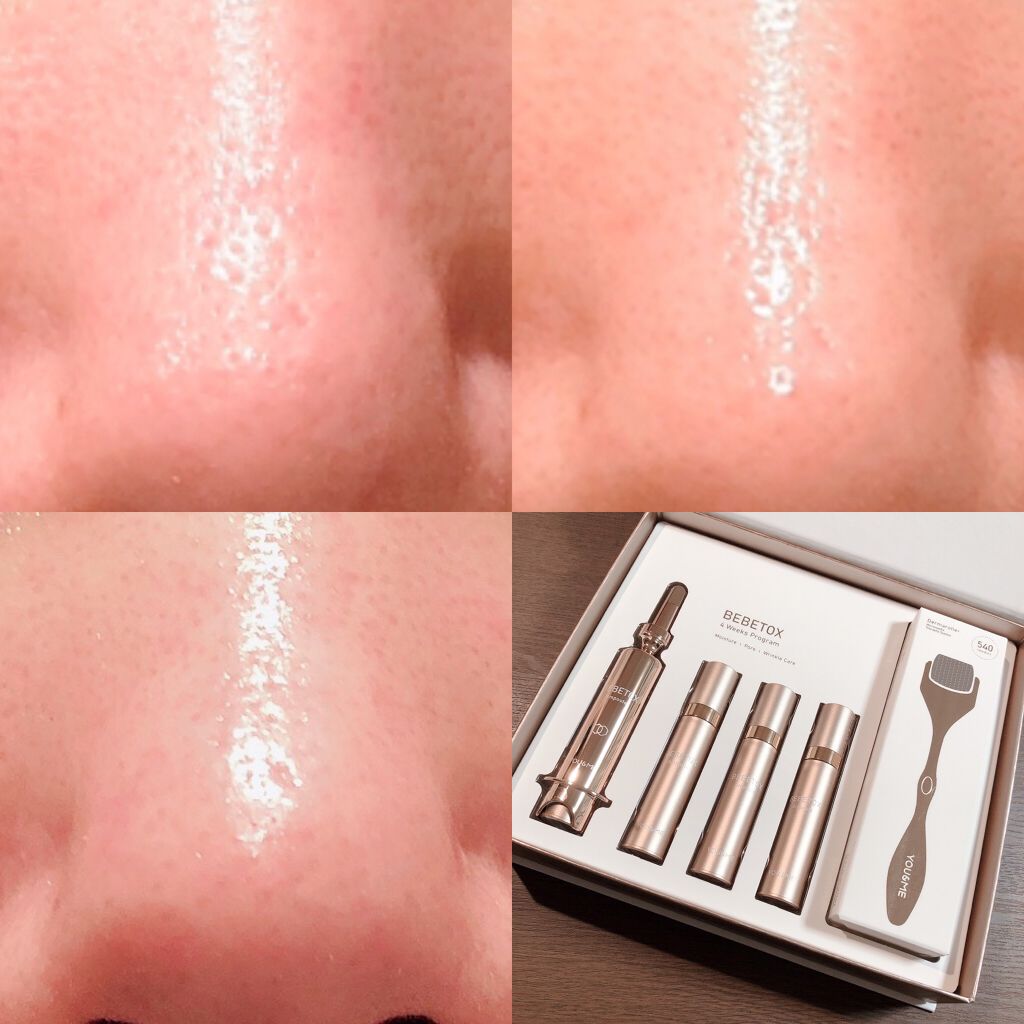 BEBETOXアンプルセット/YOU&ME/スキンケアキットを使ったクチコミ（2枚目）