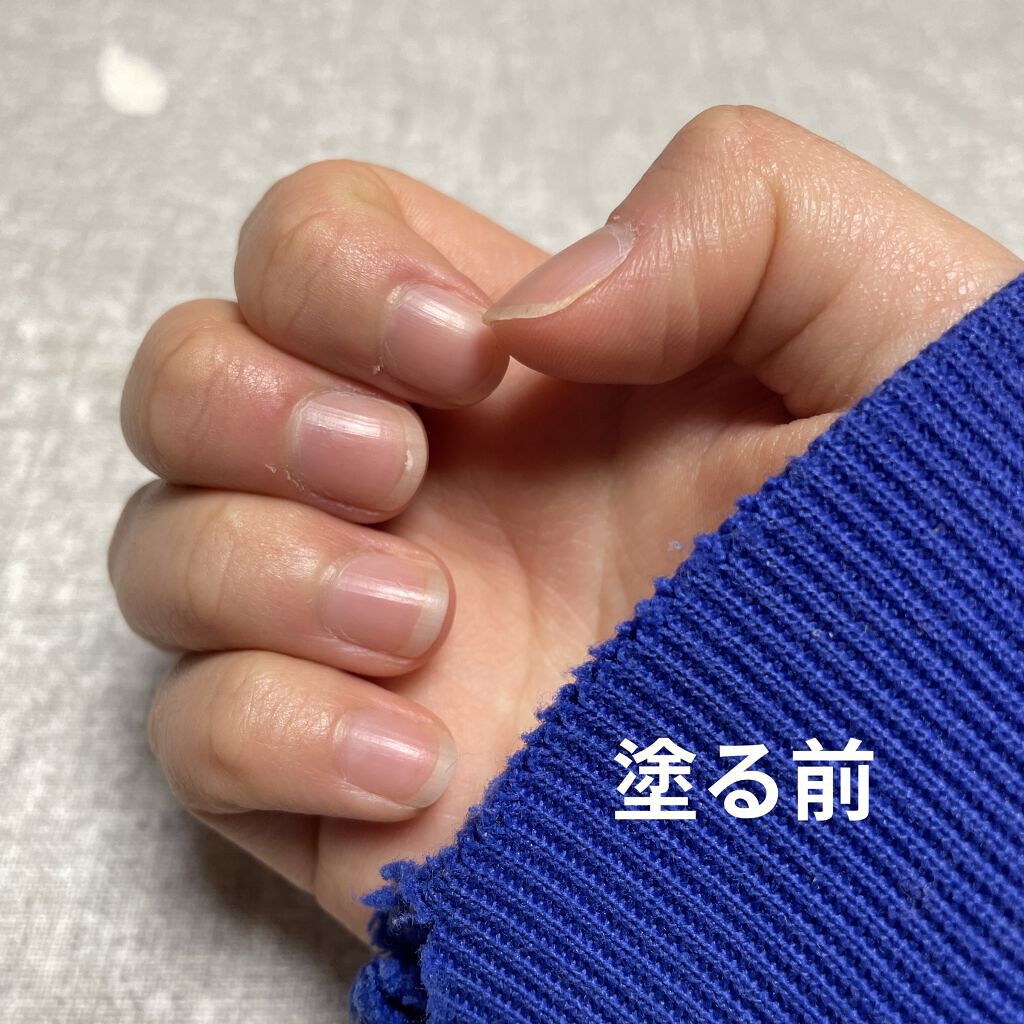 エテュセ クイックケアコート/ettusais/ネイルオイル・トリートメントを使ったクチコミ（3枚目）