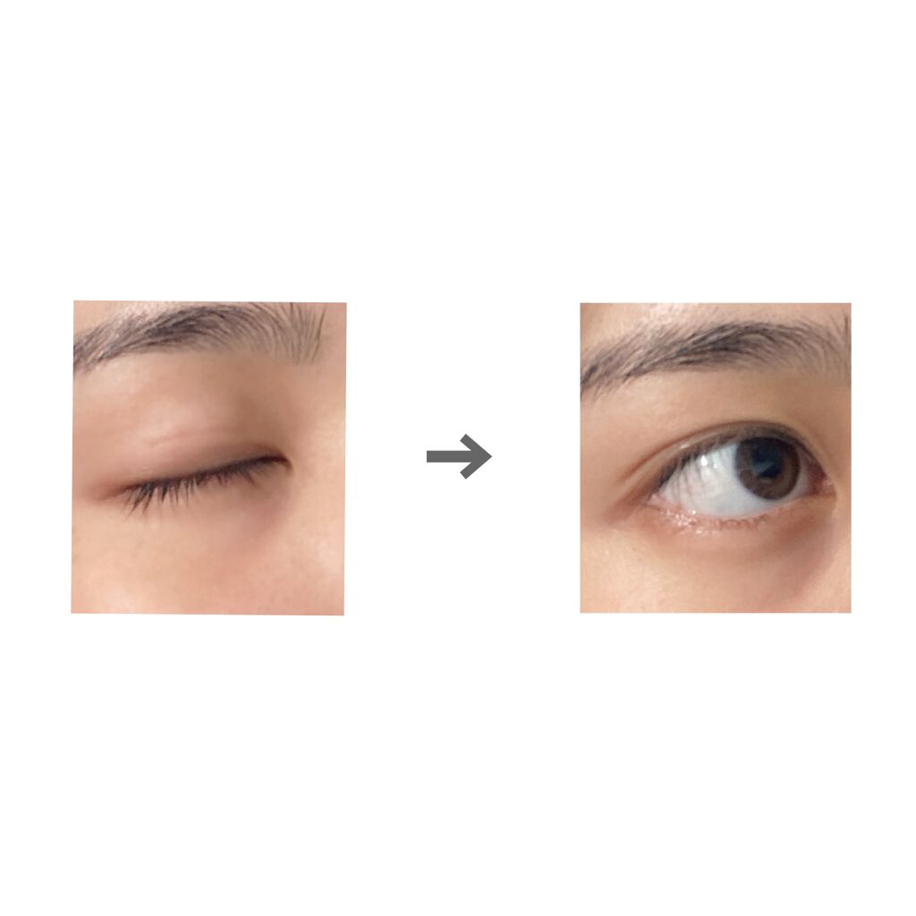 のびーるアイテープ(絆創膏タイプ、レギュラー)/DAISO/二重まぶた用アイテムを使ったクチコミ(4枚目)