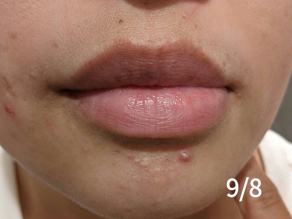 チョコラBBプラス (医薬品)/チョコラBB/その他を使ったクチコミ(2枚目)