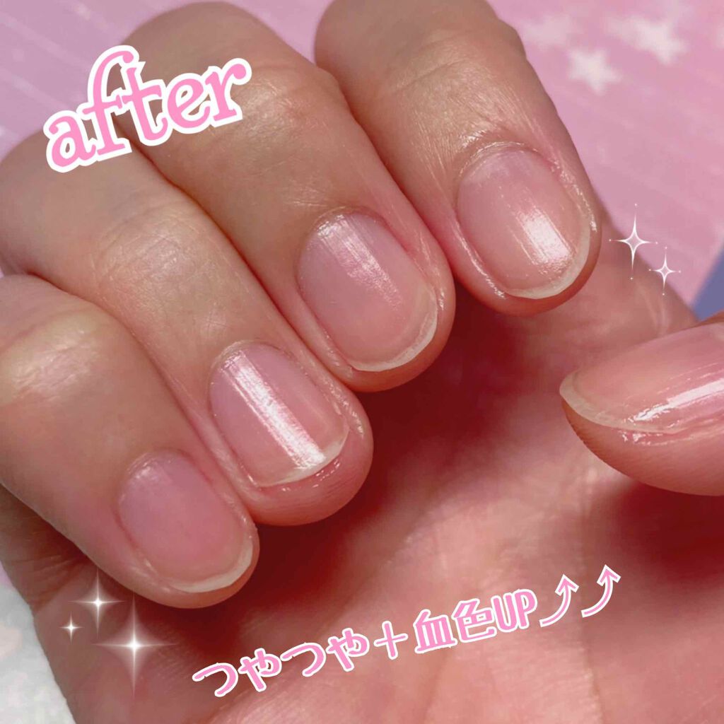 グロウケアコート/デュカート/ネイルオイル・トリートメントを使ったクチコミ（3枚目）