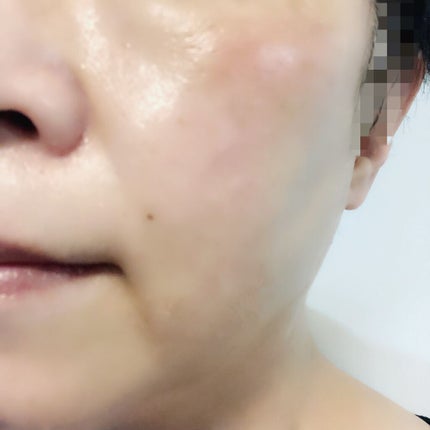 プレミアムトリートメントマスク/SUIKO HATSUCURE/シートマスク・パックを使ったクチコミ(6枚目)