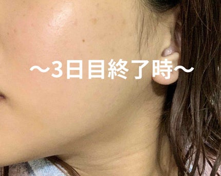 プレディア スパ・エ・メール ファンゴ W クレンズ/Prédia/クレンジングクリームを使ったクチコミ(3枚目)