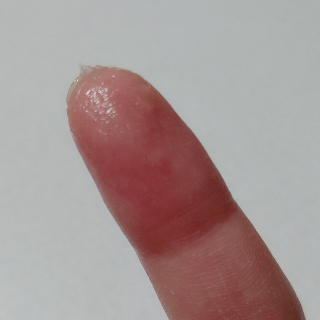 Lip Medex/Blistex/リップバームを使ったクチコミ（3枚目）