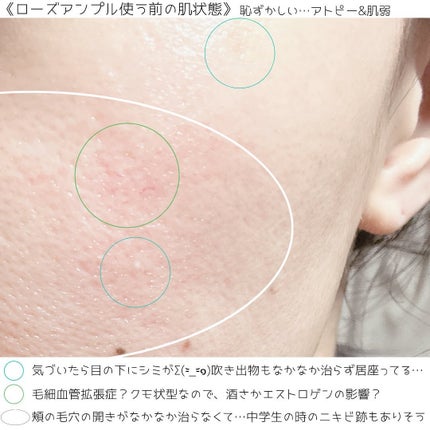 ローズステムセルセラム/Bonajour/美容液を使ったクチコミ(7枚目)