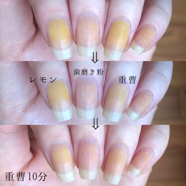 6ステップネイルケア Daisoの口コミ 超優秀 100均で買えるおすすめネイル用品 爪が黄ばんでしまいまし By Hekmatyar 代後半 Lips
