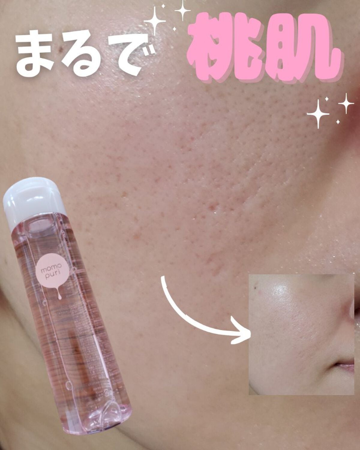 潤いバリア化粧水/ももぷり/化粧水を使ったクチコミ(1枚目)