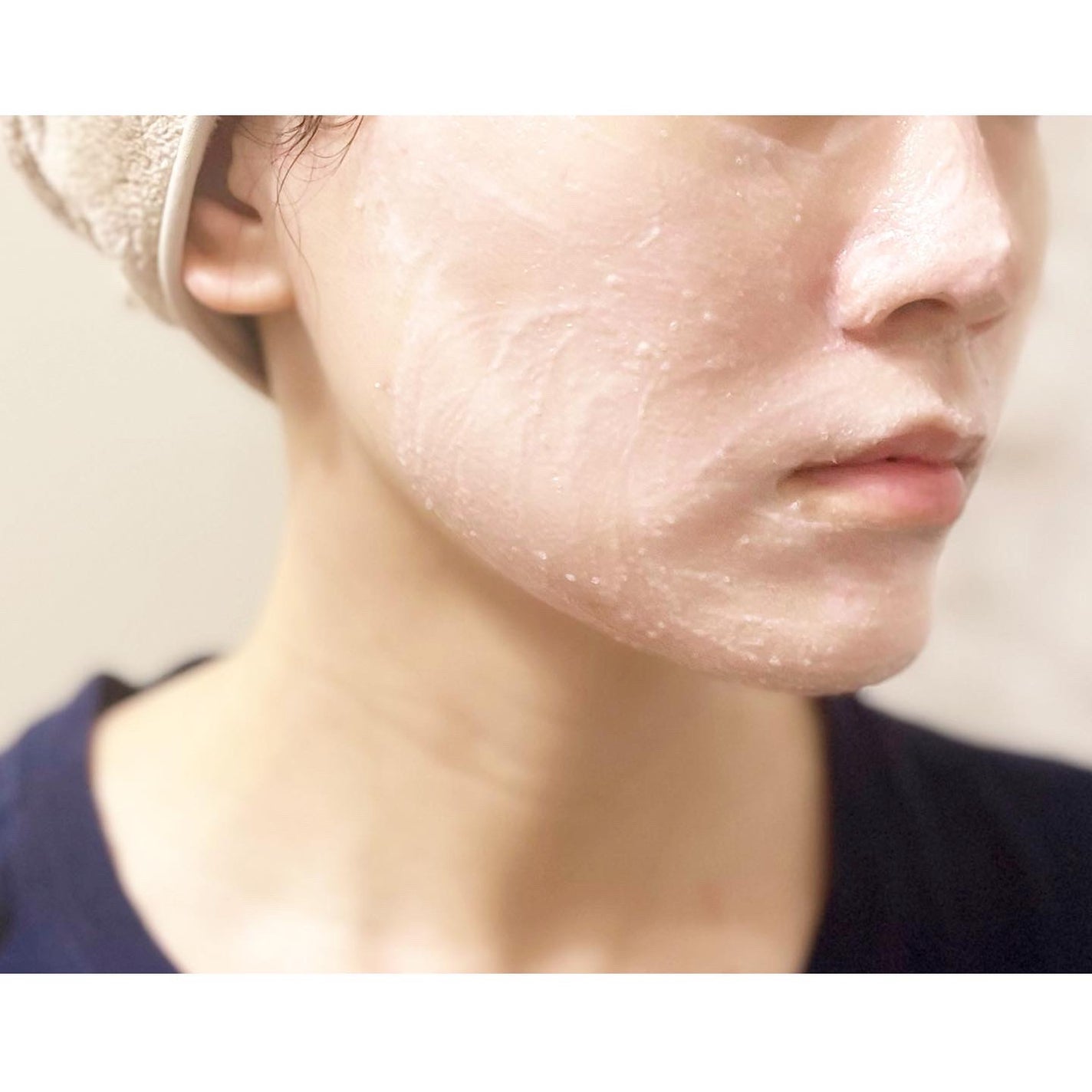 ピンクティーツリーライスシカウォッシュオフパック/APLIN/洗い流すパック・マスクを使ったクチコミ(3枚目)