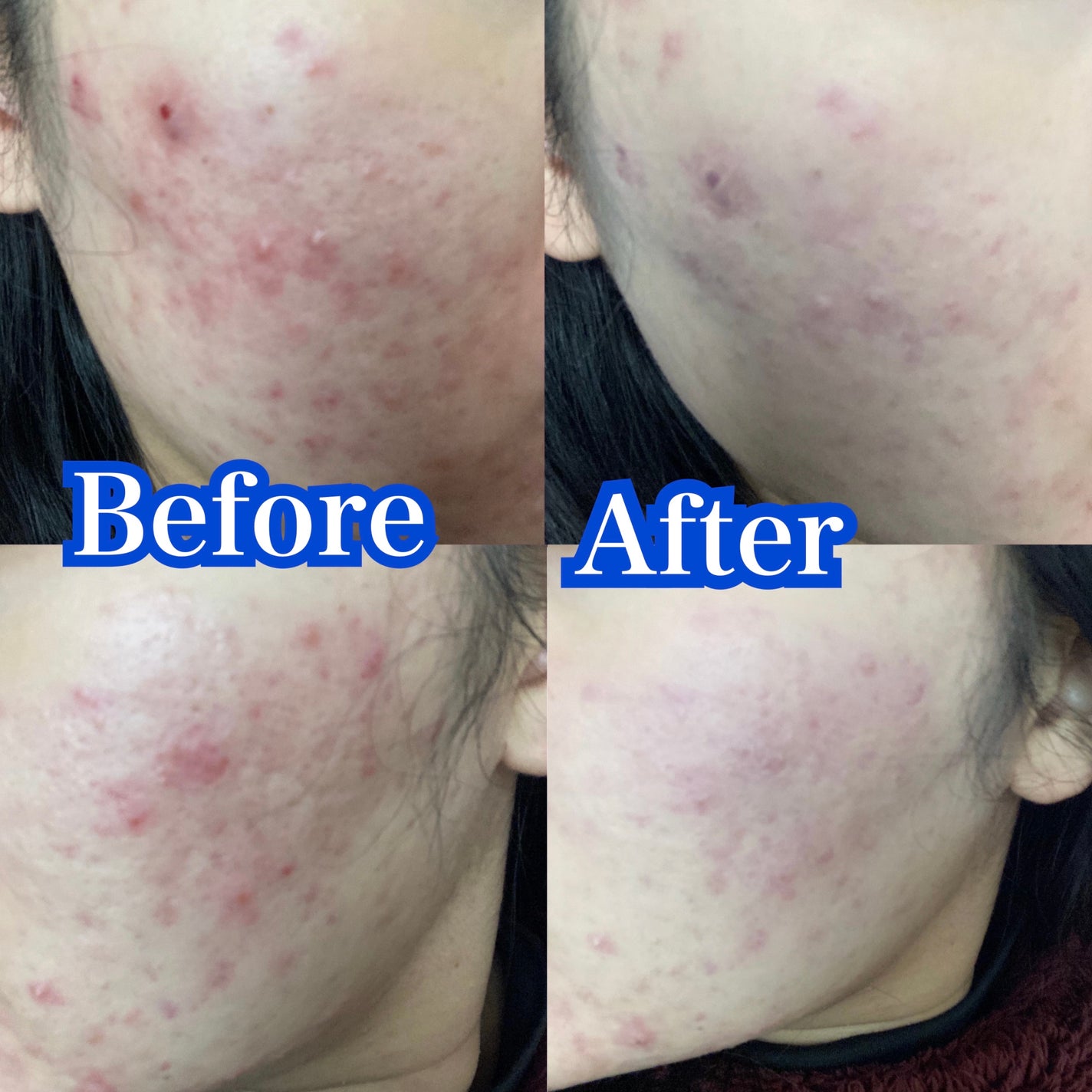 ãã©ã³ã·ãŒãè¬çšïŒµïŒ¶ããŠããŒïŒ¥ïŒž/ãã©ã³ã·ãŒã/æ¥çŒãæ¢ãããŠããŒã䜿ã£ãã¯ãã³ãïŒ5æç®ïŒ