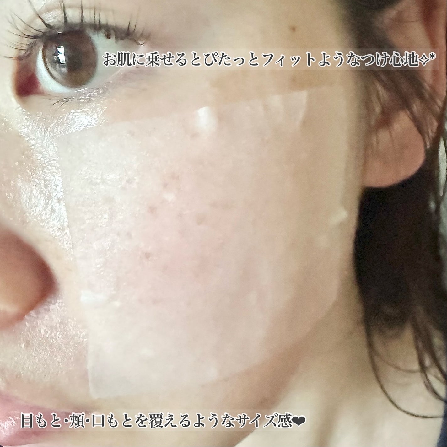 リズム べース ポイント集中パック(シャイン)/RISM/シートマスク・パックを使ったクチコミ(4枚目)