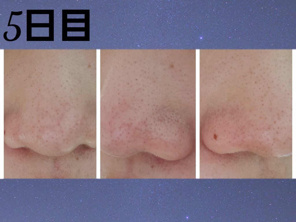 お米のマスク/毛穴撫子/シートマスク・パックを使ったクチコミ(9枚目)