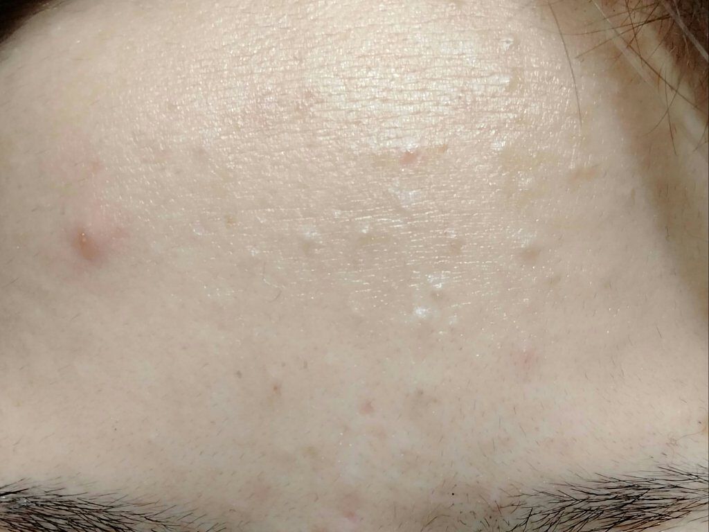 大島椿(ツバキ油)/大島椿/ヘアオイルを使ったクチコミ（2枚目）