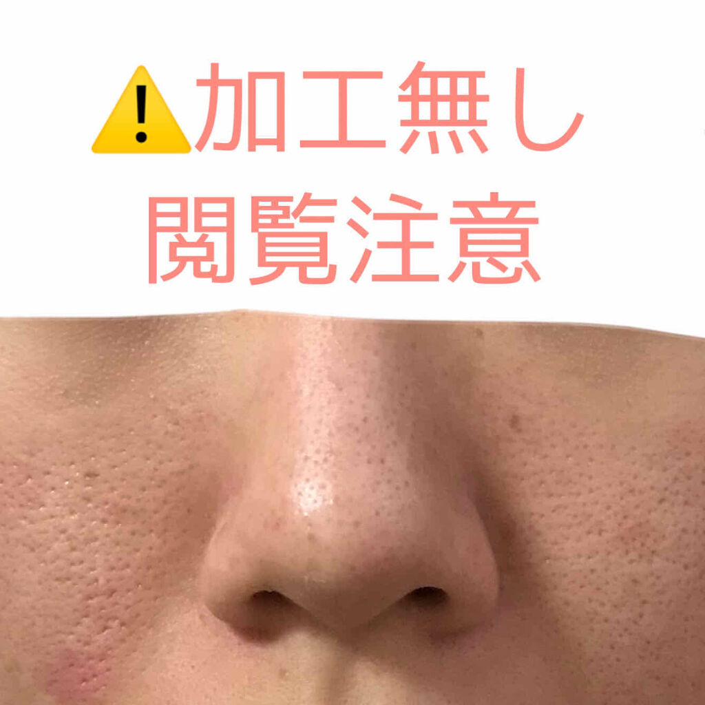 明色美顔水 薬用化粧水/美顔/化粧水を使ったクチコミ（1枚目）