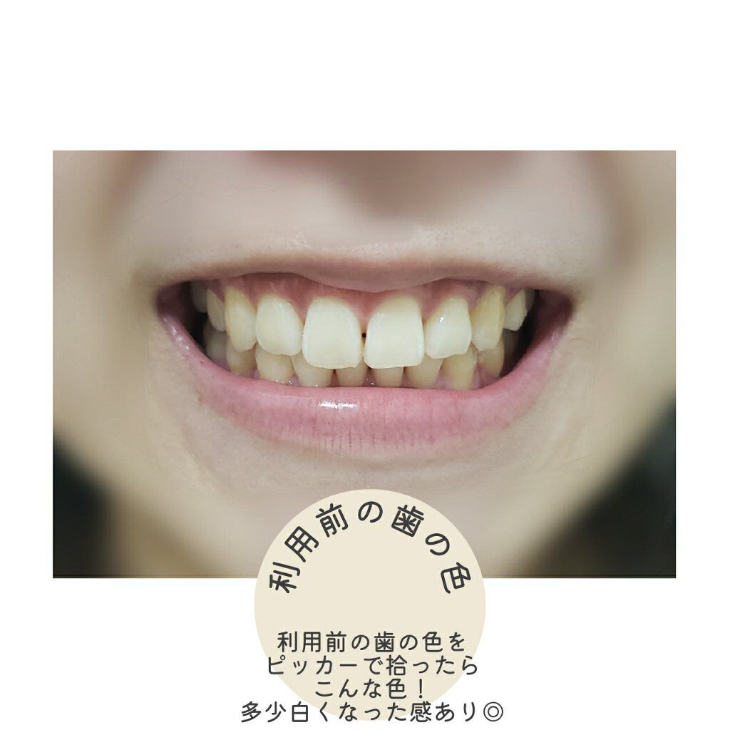 ホワイティエッセンス/MiiS/その他オーラルケアを使ったクチコミ(4枚目)